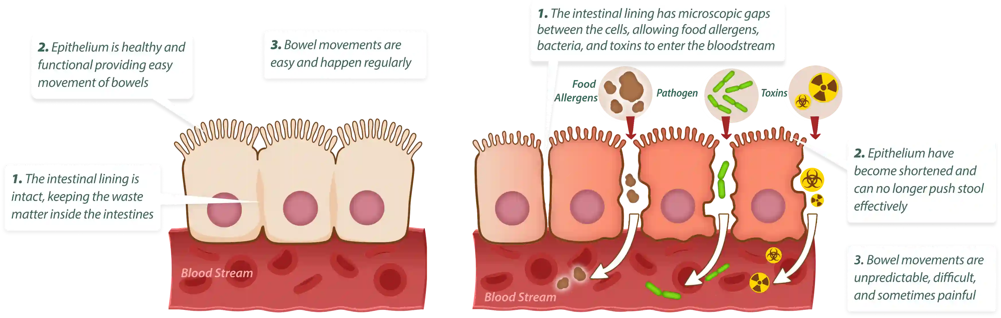 How EmmaRelife works – 3-step gut cleansing and healing process