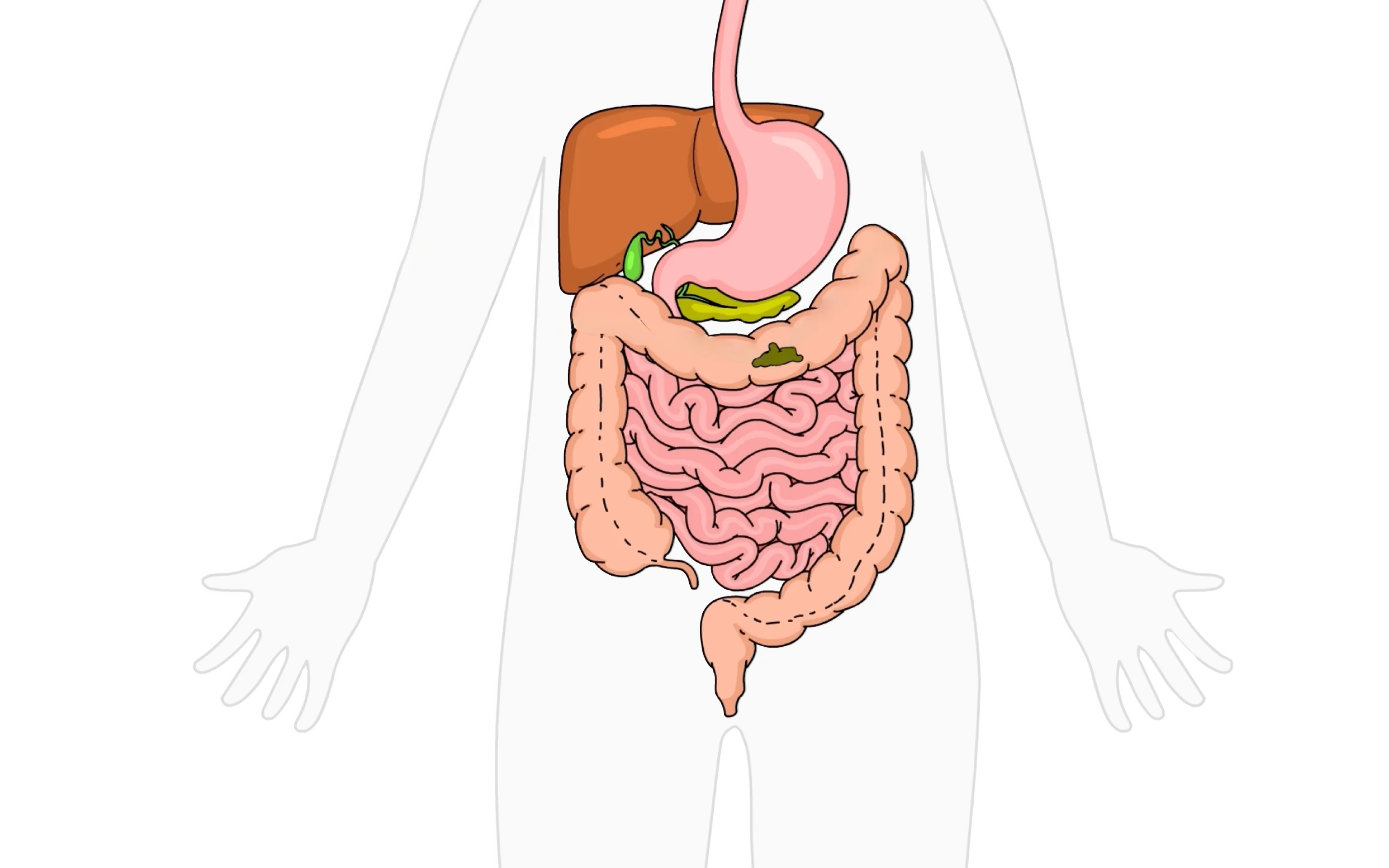 EmmaRelife gut health video illustration