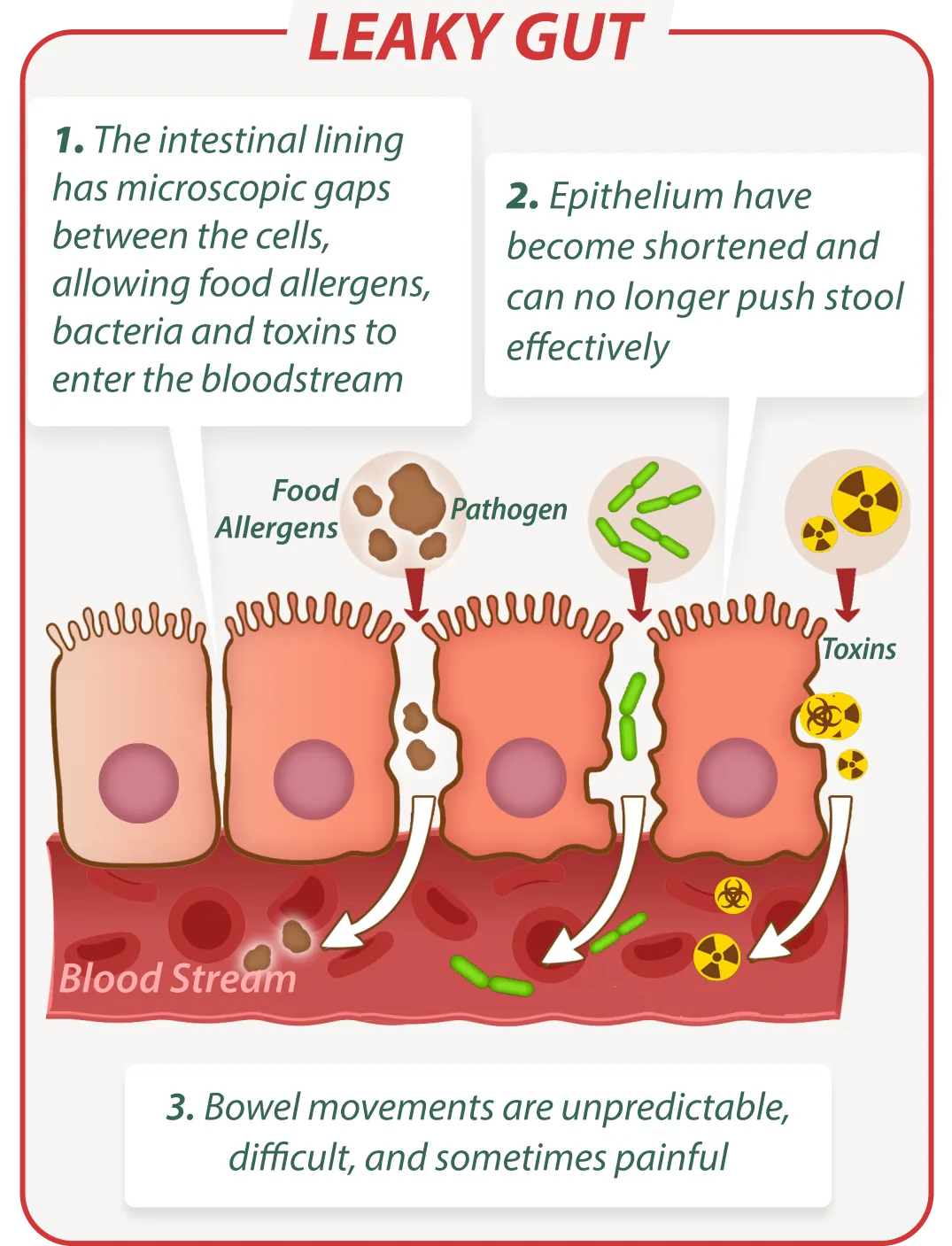 Leaky gut without EmmaRelife – digestive issues illustration